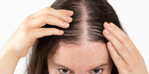 Cách Khắc Phục Rụng Tóc Ở Nữ Giới: Nguyên Nhân Và Giải Pháp