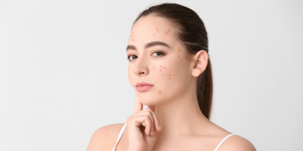 Mẹo Giúp Tóc Không Bị Bết, Nhờn Khi Tập Thể Dục Hiệu Quả