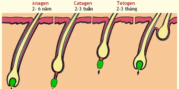 Rụng Tóc Là Gì? Nguyên Nhân, Cách Điều Trị Và Phòng Ngừa