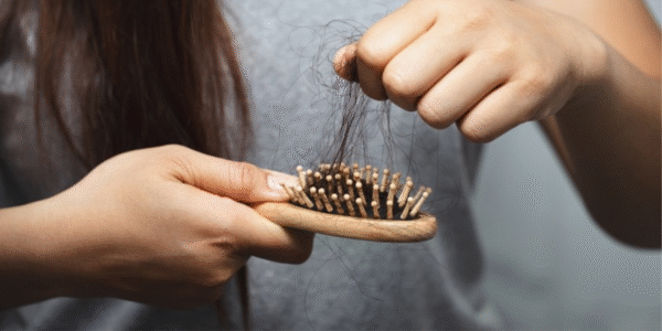 Rụng Tóc Là Gì? Nguyên Nhân, Cách Điều Trị Và Phòng Ngừa