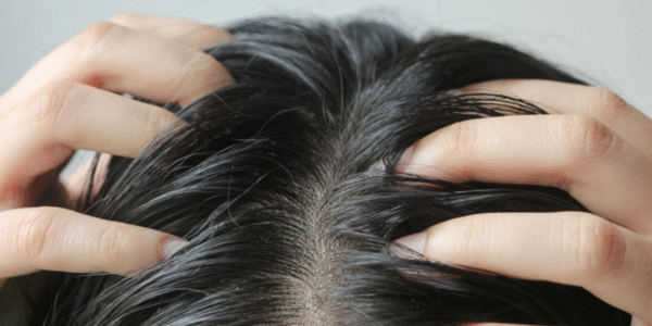 Tóc Sâu Là Gì? Tại Sao Có Tóc Sâu, Có Nên Nhổ Không?